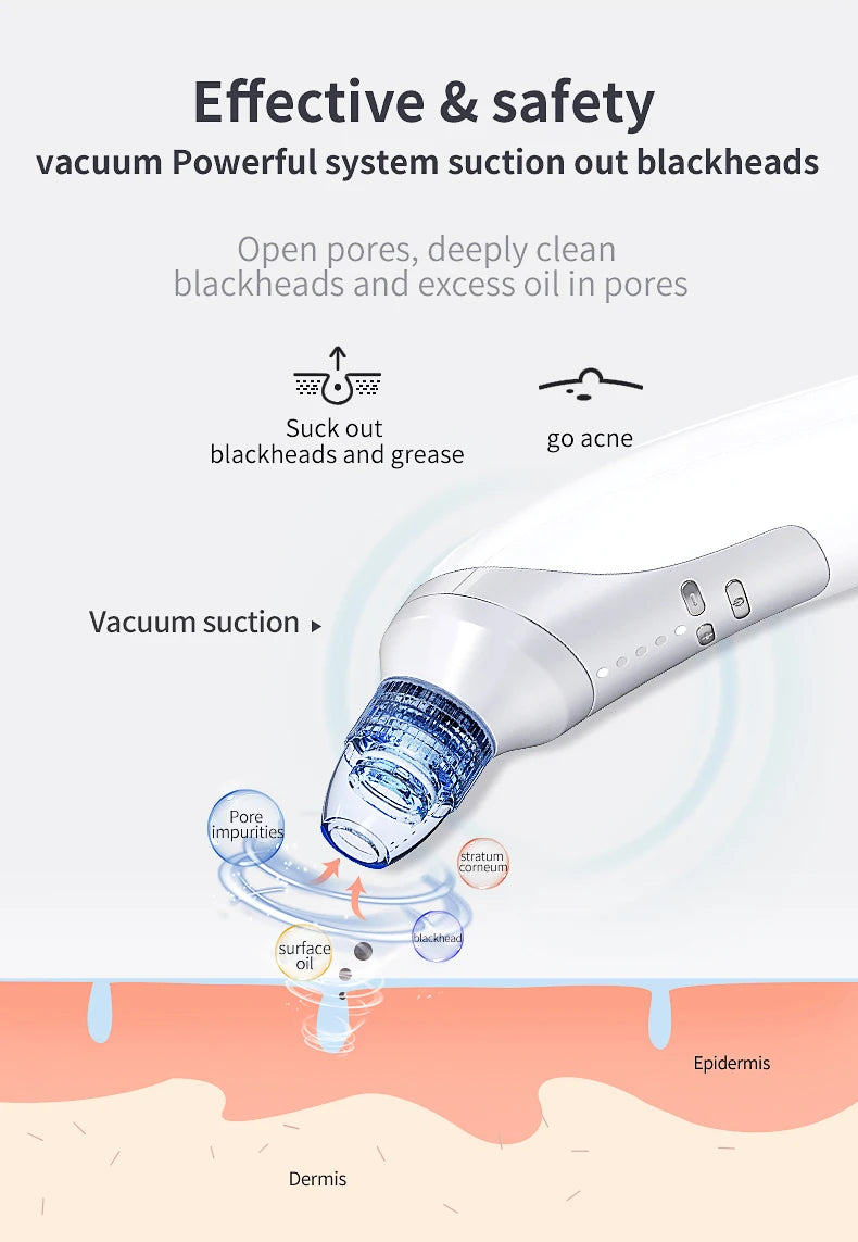 Vacuum Blackhead Remover Pore Cleaner Comedo Microdermabrasion Face Pore Cleaning Blackhead Suction Machine